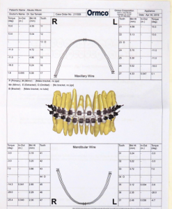 デジタル歯列矯正治療システム　INSIGNIA