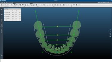 デジタル歯列矯正治療システム　INSIGNIA